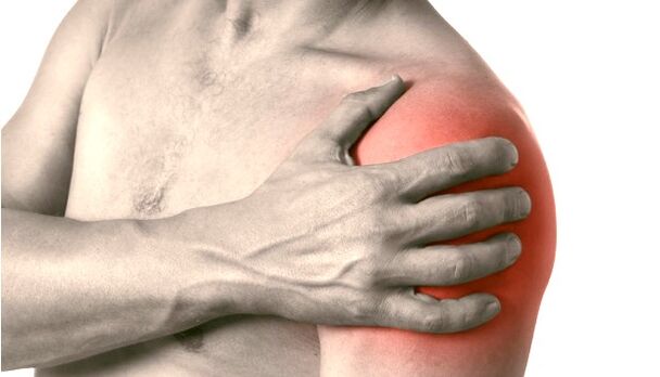 Swollen, red and enlarged shoulder - symptoms of 2-3 degree arthrosis of the shoulder joint