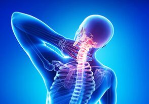 Signs of cervical osteocondrosis