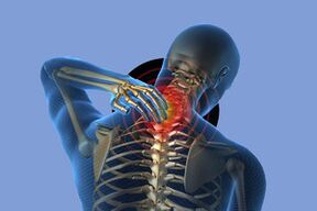 Symptoms of cervical osteocondrosis