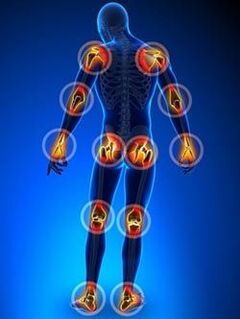 Localization of joints affected by Arthosis