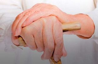 Pain in the joints of the fingers with rheumatoid arthritis
