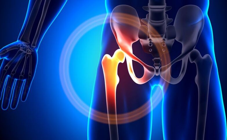pain in the hip joint