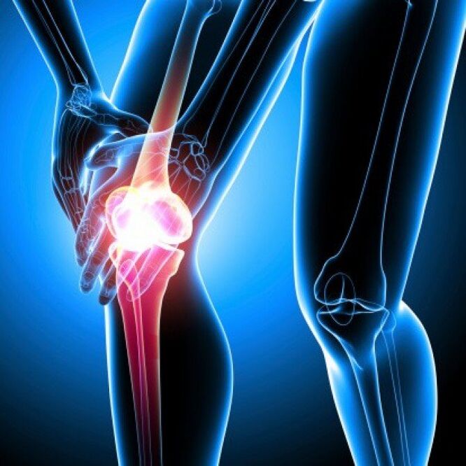 Advanced rheumatoid arthritis can cause hip pain