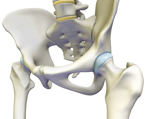 Osteochondrosis causes severe pain in the hip joint