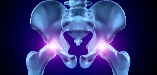osteoarthritis of the hip joint